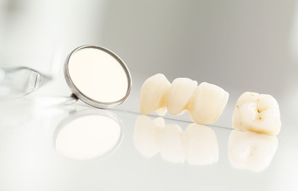 当院のセラミック治療の特徴