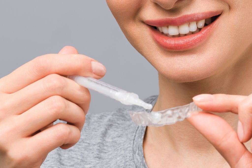 ホワイトニング