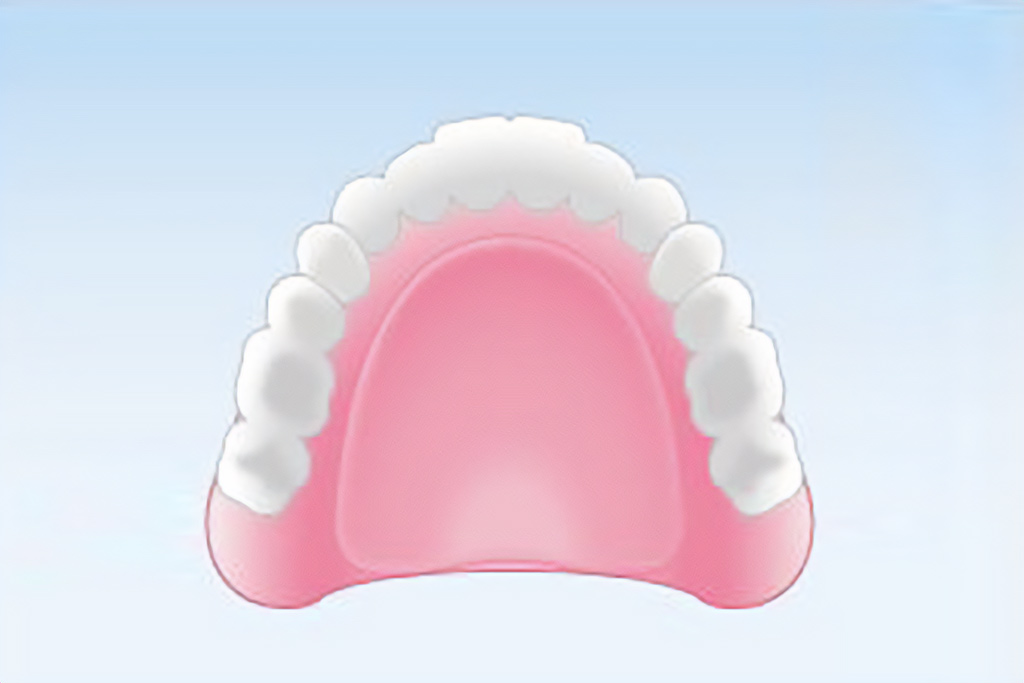 レジン床義歯（総入れ歯）