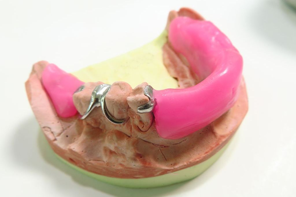 かみ合わせの調整