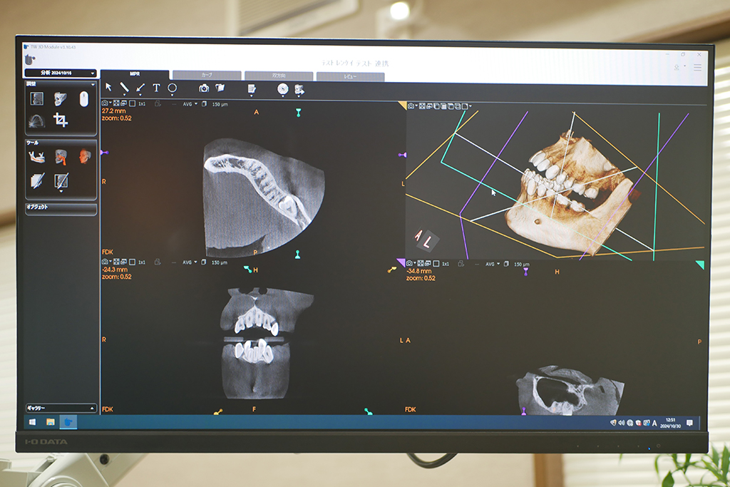 説明用モニター
