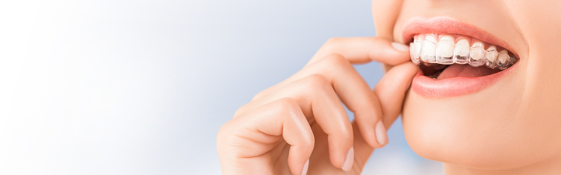 矯正歯科・小児矯正歯科