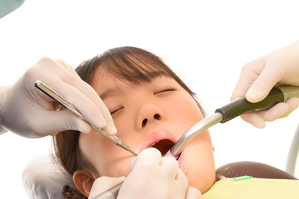 MTAセメントを使用したむし歯治療